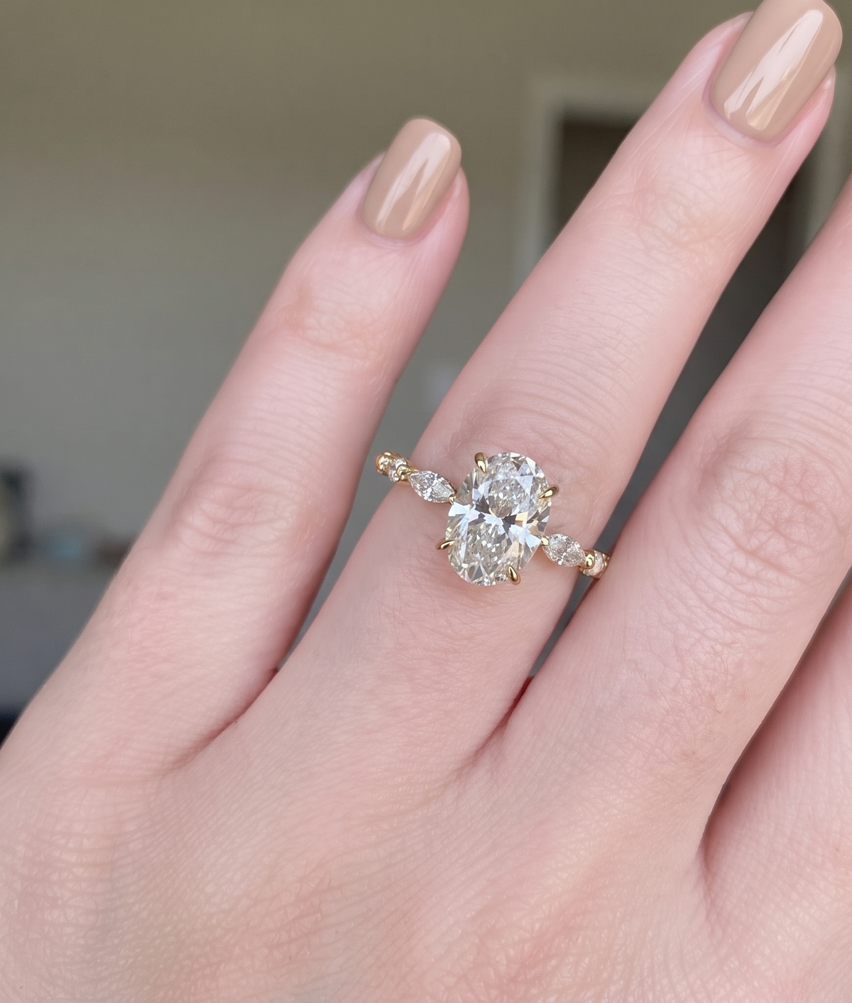 Dioress ring (Adjustable)
